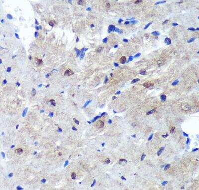 Immunohistochemistry-Paraffin PSME4 Antibody - Azide and BSA Free