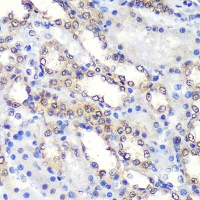 Immunohistochemistry-Paraffin PSME4 Antibody - Azide and BSA Free