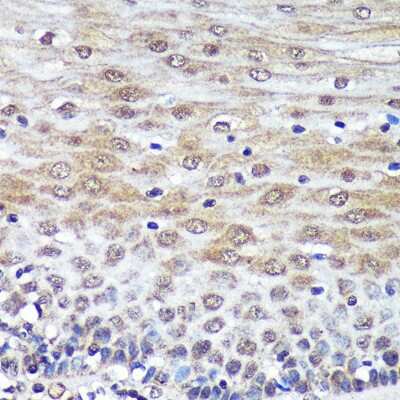 Immunohistochemistry-Paraffin PSME4 Antibody - Azide and BSA Free