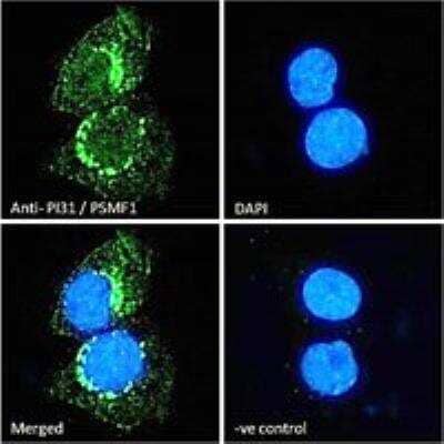 Immunocytochemistry/Immunofluorescence: PSMF1 Antibody - Isoform 1 [NB100-1178] - Immunofluorescence analysis of paraformaldehyde fixed A431 cells, permeabilized with 0.15% Triton. Primary incubation 1hr (10ug/ml) followed by Alexa Fluor 488 secondary antibody (2ug/ml), showing endoplasmic reticulum and cytoplasmic staining. The nuclear stain is DAPI (blue). Negative control: Unimmunized goat IgG (10ug/ml) followed by Alexa Fluor 488 secondary antibody (2ug/ml).