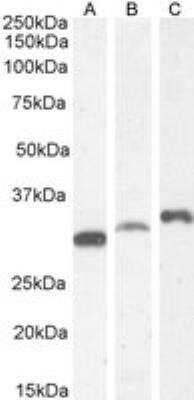 Western Blot: PSMF1 Antibody - Isoform 1 [NB100-1178] - Staining of HEK293 (A), K562 (B) with antibody at 0.3 ug/mL and LNCaP (C) cell lysate with 1 ug/mL (35 ug protein in RIPA buffer). Detected by chemiluminescence.