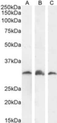 Western Blot PSMF1 Antibody - Isoform 1