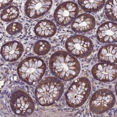 Immunohistochemistry-Paraffin: PSMF1 Antibody [NBP1-80911] - Staining of human colon shows moderate cytoplasmic positivity in glandular cells.