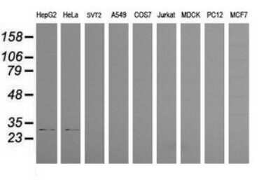 Western Blot: PSMF1 Antibody (OTI2D7) - Azide and BSA Free [NBP2-73707] - Analysis of extracts (35ug) from 9 different cell lines. (HepG2: human; HeLa: human; SVT2: mouse; A549: human; COS7: monkey; Jurkat: human; MDCK: canine; PC12: rat; MCF7: human)