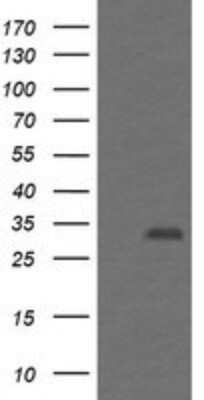Western Blot: PSMF1 Antibody (OTI2D7) - Azide and BSA Free [NBP2-73707] - Analysis of HEK293T cells were transfected with the pCMV6-ENTRY control (Left lane) or pCMV6-ENTRY PSMF1.