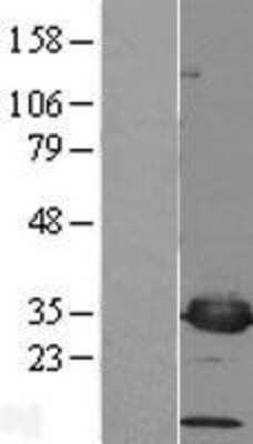 Western Blot PSMF1 Overexpression Lysate