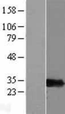 Western Blot PSMF1 Overexpression Lysate