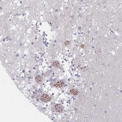 Immunohistochemistry: PSMG1 Antibody [NBP2-33820] - Staining of human cerebellum shows strong granular cytoplasmic positivity in Purkinje cells.