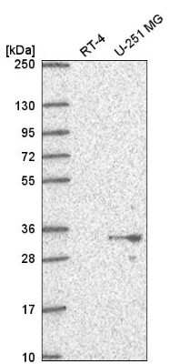 Western Blot: PSMG1 Antibody [NBP2-55971] - Western blot analysis in human cell line RT-4 and human cell line U-251 MG.