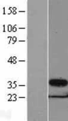 Western Blot PSMG1 Overexpression Lysate