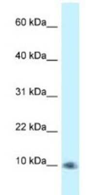 PSMG3 Antibody (NBP1-79828): Novus Biologicals