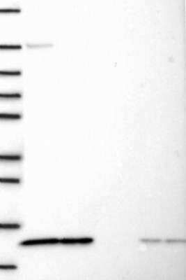 Western Blot: PSMG4 Antibody [NBP3-17615] - Lane 1: Marker [kDa] 250, 130, 95, 72, 55, 36, 28, 17, 10 | Lane 2: RT4 | Lane 3: U-251 MG | Lane 4: Human Plasma | Lane 5: Liver | Lane 6: Tonsil