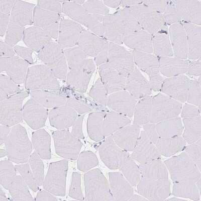 Immunohistochemistry-Paraffin: PSORS1C2 Antibody [NBP2-32589] - Staining of human skeletal muscle shows low expression as expected.