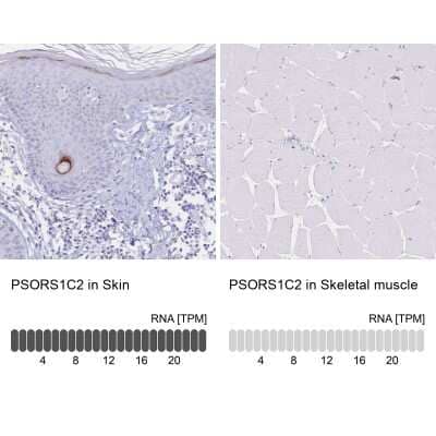 Immunohistochemistry-Paraffin: PSORS1C2 Antibody [NBP2-32589] - Staining in human skin and skeletal muscle tissues using anti-PSORS1C2 antibody. Corresponding PSORS1C2 RNA-seq data are presented for the same tissues.