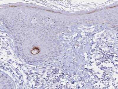 Immunohistochemistry-Paraffin: PSORS1C2 Antibody [NBP2-32589] - Staining of human skin shows high expression.
