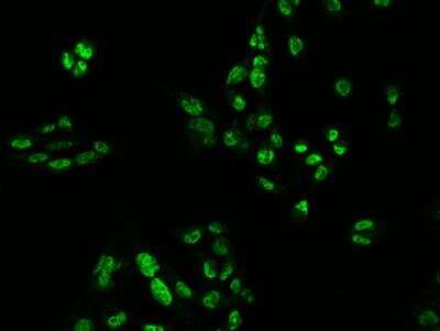 Immunocytochemistry/Immunofluorescence: PSPC1 Antibody [NBP3-12643] - Staining of PSPC1 in U251MG cells. Cells were fixed with 4% PFA, permeabilzed with 0.3% Triton X-100 in PBS,blocked with 10% serum, and incubated with rabbit anti-Human PSPC1 polyclonal antibody (dilution ratio 1:200) at 4? overnight. Then cells were stained with the Alexa Fluor®488-conjugated Goat Anti-rabbit IgG secondary antibody (green). Positive staining was localized to Nucleus.