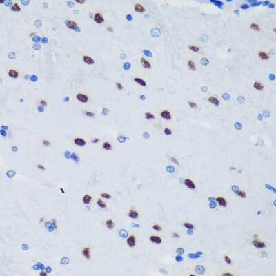 Immunohistochemistry-Paraffin: PSPC1 Antibody [NBP2-93111] - Immunohistochemistry of paraffin-embedded Rat brain using PSPC1 Rabbit pAb (NBP2-93111) at dilution of 1:100 (40x lens). Perform microwave antigen retrieval with 10 mM PBS buffer pH 7.2 before commencing with IHC staining protocol.
