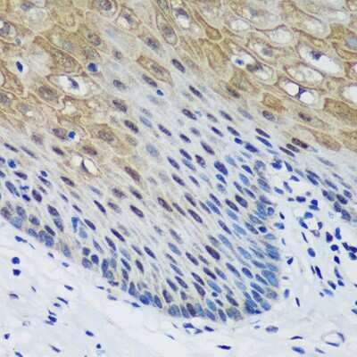 Immunohistochemistry-Paraffin: PSPC1 Antibody [NBP2-93111] - Immunohistochemistry of paraffin-embedded Human esophageal using PSPC1 Rabbit pAb (NBP2-93111) at dilution of 1:100 (40x lens). Perform microwave antigen retrieval with 10 mM PBS buffer pH 7.2 before commencing with IHC staining protocol.