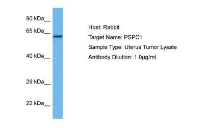 Western Blot: PSPC1 Antibody [NBP2-83428] - Host: Rabbit. Target Name: PSPC1. Sample Tissue: Human Uterus Tumor lysates. Antibody Dilution: 1ug/ml