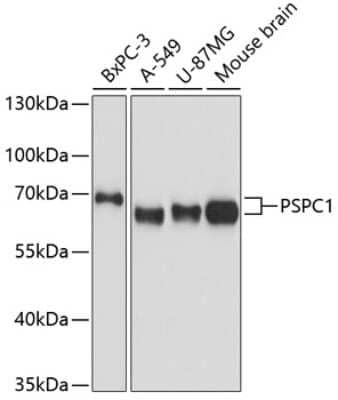 Western Blot: PSPC1 Antibody [NBP2-93111] - Analysis of extracts of various cell lines, using PSPC1 at 1:3000 dilution. Secondary antibody: HRP Goat Anti-Rabbit IgG (H+L) at 1:10000 dilution. Lysates/proteins: 25ug per lane. Blocking buffer: 3% nonfat dry milk in TBST. Detection: ECL Basic Kit . Exposure time: 10s.