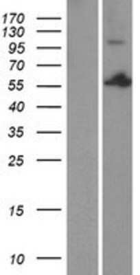 Western Blot: PSPC1 Overexpression Lysate (Adult Normal) [NBP2-08362] Left-Empty vector transfected control cell lysate (HEK293 cell lysate); Right -Over-expression Lysate for PSPC1.