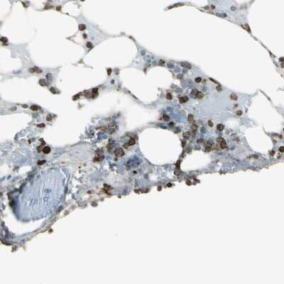 Immunohistochemistry-Paraffin PSTPIP1 Antibody