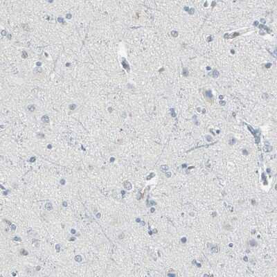 Immunohistochemistry-Paraffin PSTPIP1 Antibody