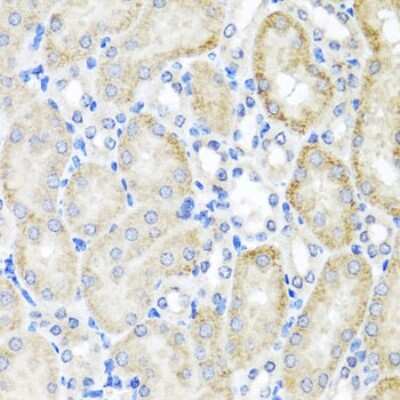 Immunohistochemistry-Paraffin: PSTPIP1 Antibody [NBP2-93547] - Paraffin-embedded mouse kidney using PSTPIP1 .