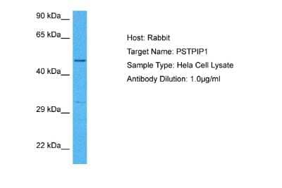 Western Blot: PSTPIP1 Antibody [NBP2-85555] - Host: Rabbit. Target Name: PSTPIP1. Sample Tissue: Human Hela Whole Cell lysates. Antibody Dilution: 1ug/ml