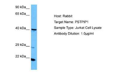 Western Blot: PSTPIP1 Antibody [NBP2-85556] - Host: Rabbit. Target Name: PSTPIP1. Sample Tissue: Human Jurkat Whole Cell lysates. Antibody Dilution: 1ug/ml