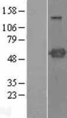 Western Blot PSTPIP1 Overexpression Lysate