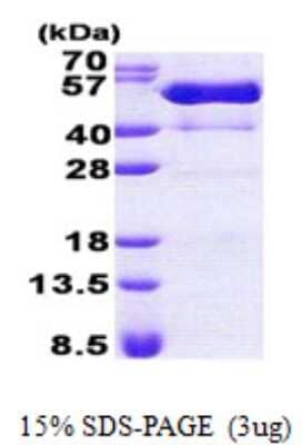 SDS-PAGE Recombinant Human PSTPIP1 His Protein