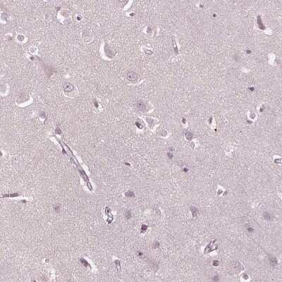 Immunohistochemistry-Paraffin PSTPIP2 Antibody