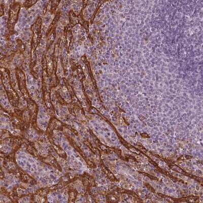 Immunohistochemistry-Paraffin PSTPIP2 Antibody