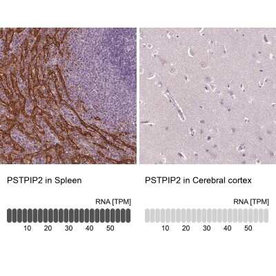 Immunohistochemistry-Paraffin PSTPIP2 Antibody