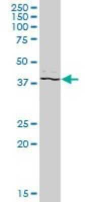 Western Blot: PSTPIP2 Antibody [H00009050-B01P] - Analysis of PSTPIP2 expression in human pancreas.