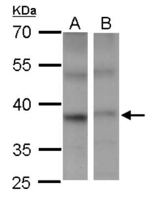 Western Blot: PSTPIP2 Antibody [NBP2-19995] - Sample (20 ug of whole cell lysate) A: Raw264. 7 B: Raw264. 7 knock down PSTPIP2 NBP2-19995 diluted at 1:2000.