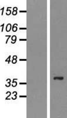 Western Blot: PSTPIP2 Overexpression Lysate (Adult Normal) [NBP2-06333] Left-Empty vector transfected control cell lysate (HEK293 cell lysate); Right -Over-expression Lysate for PSTPIP2.