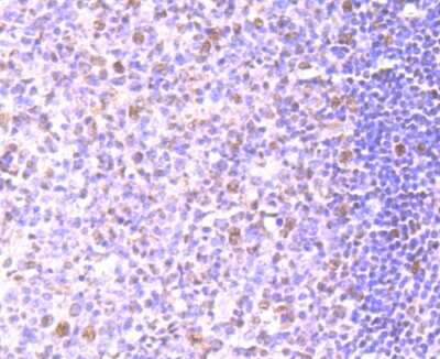 Immunohistochemistry-Paraffin: PTBP1 Antibody (5C1) [NBP2-75635] - Analysis of paraffin-embedded human tonsil tissue using anti-PTBP1 antibody. Counter stained with hematoxylin.