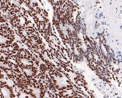 Immunohistochemistry-Paraffin: PTBP1 Antibody (5C1) [NBP2-75635] - Analysis of paraffin-embedded human placental tissue with Mouse anti-PTBP1 antibody at 1/400 dilution. The section was pre-treated using heat mediated antigen retrieval with sodium citrate buffer (pH 6.0) for 2 minutes. The tissues were blocked in 1% BSA for 20 minutes at room temperature, washed with ddH2O and PBS, and then probed with the primary antibody at 1/400 dilution for 1 hour at room temperature. The detection was performed using an HRP conjugated compact polymer system. DAB was used as the chromogen. Tissues were counterstained with hematoxylin and mounted with DPX.