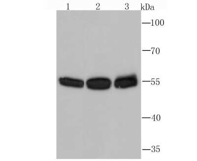 Western Blot: PTBP1 Antibody (5C1) [NBP2-75635] - Analysis of PTBP1 on different cell lysate using anti-PTBP1 antibody at 1/1,000 dilution.Positive control:Lane1: Daudi         Lane2: HelaLane3: PC-12