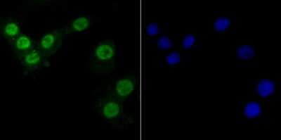 Immunocytochemistry/Immunofluorescence: PTBP1 Antibody (9A1) [NBP2-75636] - Staining PTBP1 in A549 cells (green). The nuclear counter stain is DAPI (blue). Cells were fixed in paraformaldehyde, permeabilised with 0.25% Triton X100/PBS.