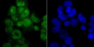 Immunocytochemistry/Immunofluorescence: PTBP1 Antibody (9A1) [NBP2-75636] - Staining PTBP1 in 293T cells (green). The nuclear counter stain is DAPI (blue). Cells were fixed in paraformaldehyde, permeabilised with 0.25% Triton X100/PBS.