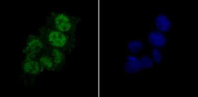 Immunocytochemistry/Immunofluorescence: PTBP1 Antibody (9A1) [NBP2-75636] - Staining PTBP1 in SW480 cells (green). The nuclear counter stain is DAPI (blue). Cells were fixed in paraformaldehyde, permeabilised with 0.25% Triton X100/PBS.