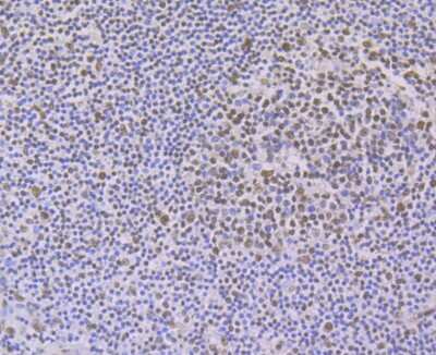 Immunohistochemistry-Paraffin: PTBP1 Antibody (9A1) [NBP2-75636] - Analysis of paraffin-embedded human tonsil tissue using anti-PTBP1 antibody. Counter stained with hematoxylin.