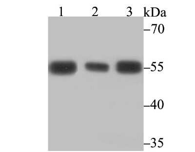 Western Blot: PTBP1 Antibody (9A1) [NBP2-75636] - Analysis of PTBP1 on different cell lysates using anti-PTBP1 antibody at 1/5,000 dilution.Positive control:Lane 1: Jurkat        Lane 2: A431Lane 3: K562