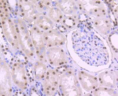 Immunohistochemistry-Paraffin: PTBP1 Antibody (JU41-20) [NBP2-75634] - Analysis of paraffin-embedded human kidney tissue using anti-PTBP1 antibody. Counter stained with hematoxylin.