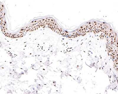 Immunohistochemistry-Paraffin: PTBP1 Antibody (JU41-20) [NBP2-75634] - Analysis of paraffin-embedded human skin tissue with Rabbit anti-PTBP1 antibody washed with ddH2O and PBS, and then probed with the primary antibody  at 1/400 dilution for 1 hour at room temperature. The detection was performed using an HRP conjugated compact polymer system. DAB was used as the chromogen. Tissues were counterstained with hematoxylin and mounted with DPX.