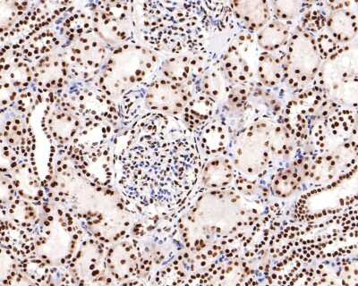 Immunohistochemistry-Paraffin: PTBP1 Antibody (JU41-20) [NBP2-75634] - Analysis of paraffin-embedded human kidney tissue with Rabbit anti-PTBP1 antibody washed with ddH2O and PBS, and then probed with the primary antibody  at 1/400 dilution for 1 hour at room temperature. The detection was performed using an HRP conjugated compact polymer system. DAB was used as the chromogen. Tissues were counterstained with hematoxylin and mounted with DPX.