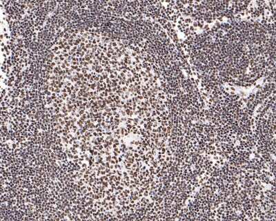 Immunohistochemistry-Paraffin: PTBP1 Antibody (JU41-20) [NBP2-75634] - Analysis of paraffin-embedded human lymph nodes tissue with Rabbit anti-PTBP1 antibody washed with ddH2O and PBS, and then probed with the primary antibody  at 1/400 dilution for 1 hour at room temperature. The detection was performed using an HRP conjugated compact polymer system. DAB was used as the chromogen. Tissues were counterstained with hematoxylin and mounted with DPX.